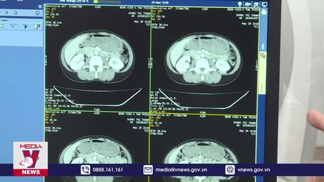 Cứu sống bệnh nhân u buồng trứng khổng lồ