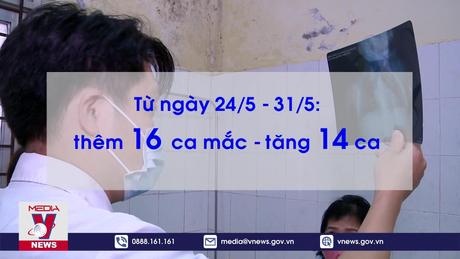Số ca mắc ho gà ở Hà Nội gà tăng mạnh