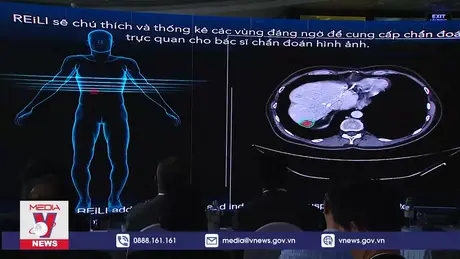 Tầm soát ung thư bằng AI đầu tiên tại Việt Nam