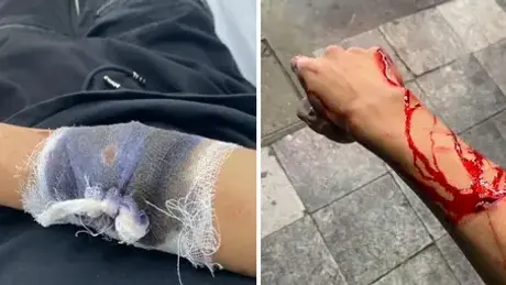 Nhóm thanh niên dùng dao chém người, cướp xe máy ngay khu vực Nhà hát lớn, Hà Nội