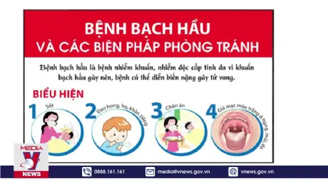 Bắc Giang khống chế không để dịch bạch hầu lây lan