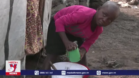 WHO cân nhắc tình trạng khẩn cấp toàn cầu về bệnh đậu mùa khỉ