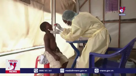 AU ban bố tình trạng khẩn cấp về dịch đậu mùa khỉ