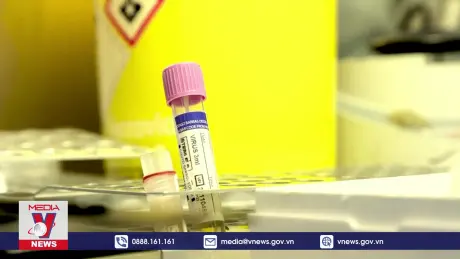 WHO không khuyến cáo hạn chế đi lại vì đậu mùa khỉ