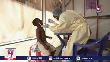 Mối nguy từ chủng mới đậu mùa khỉ