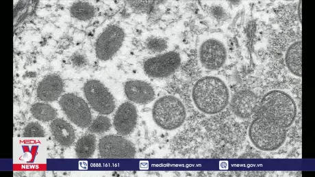 Hàn Quốc tăng cường giám sát bệnh đậu mùa khỉ