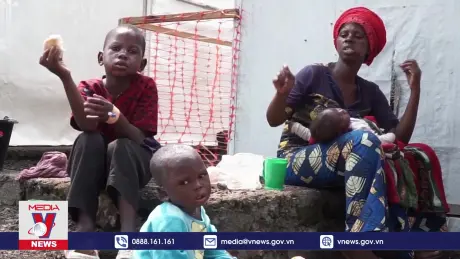 Thiếu nguồn lực y tế cản trở nỗ lực ngăn dịch đậu mùa khỉ