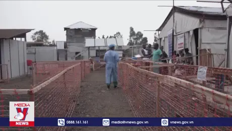 Argentina kích hoạt tình trạng khẩn cấp do bệnh đậu mùa khỉ