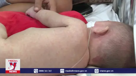 Triển khai chiến dịch tiêm vaccine sởi tại 18 tỉnh/thành