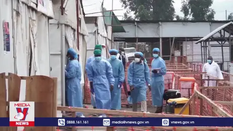 Vấn nạn bệnh đậu mùa khỉ ở Châu Phi