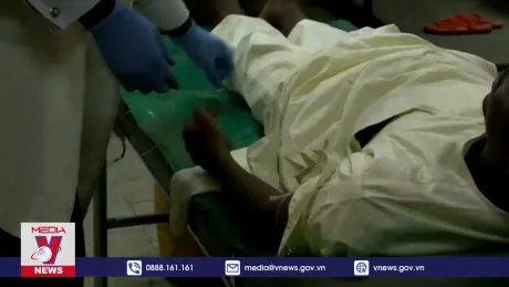 WHO khởi động kế hoạch toàn cầu ngăn chặn bệnh đậu mùa khỉ