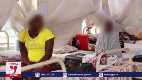 WHO khuyến cáo thận trọng với cách lây lan của bệnh đậu mùa khỉ