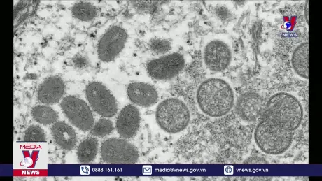 Nguy cơ virus đậu mùa khỉ biến đổi nhanh