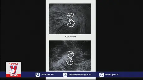 Loạt nghiên cứu hài hước giành giải Ig Nobel