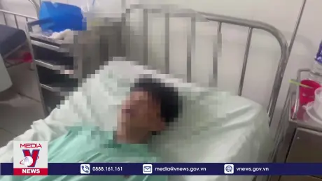 Một học sinh bị đánh hội đồng trước cổng trường, bị thương nặng