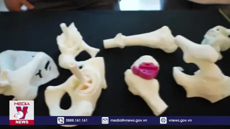 Công nghệ in 3D trong y tế: Tiềm năng lớn cho Việt Nam