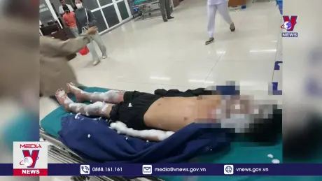 Bốn học sinh nhập viện cấp cứu do chế pháo nổ