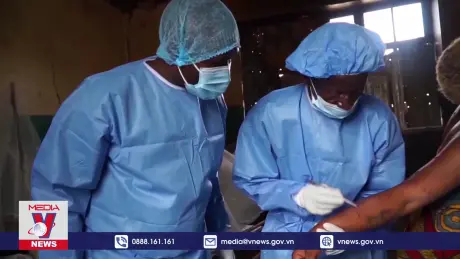 WHO cảnh báo nguy cơ từ bệnh đậu mùa khỉ tại châu Phi