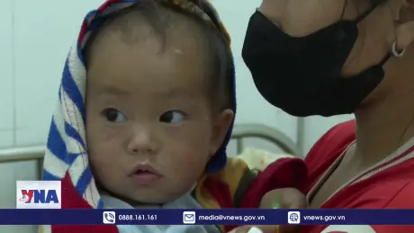 Điện Biên tăng cường khống chế dịch sởi
