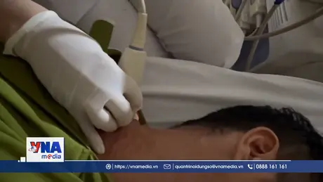 Phát hiện bệnh nhân thứ 26 mắc giun rồng tại Việt Nam