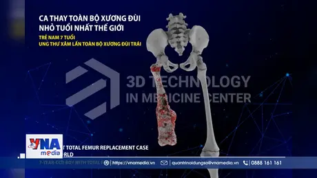 Công nghệ 3D giúp giảm chi phí, tai biến trong y khoa