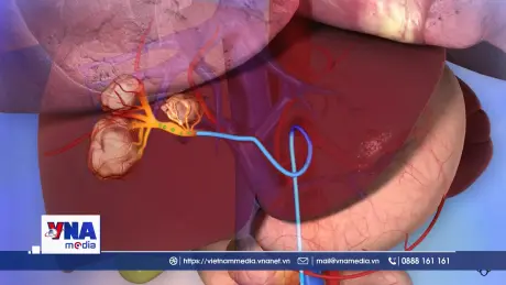 Số ca ung thư gan toàn cầu có thể tăng gấp đôi vào năm 2050