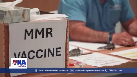 Dịch sởi bùng phát trở lại tại Canada