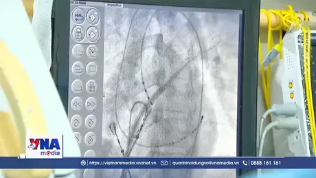 200.000 người Việt tử vong mỗi năm liên quan đến tim mạch