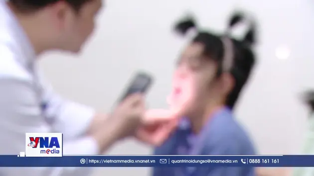 Ca mổ hiếm gặp: Kéo gương mặt về phía trước