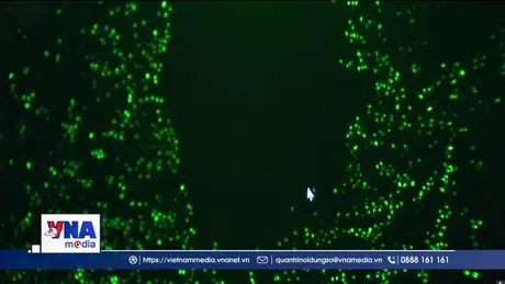 Nguy cơ tổn thương thận do tiếp xúc với lượng lớn hạt nhựa nano