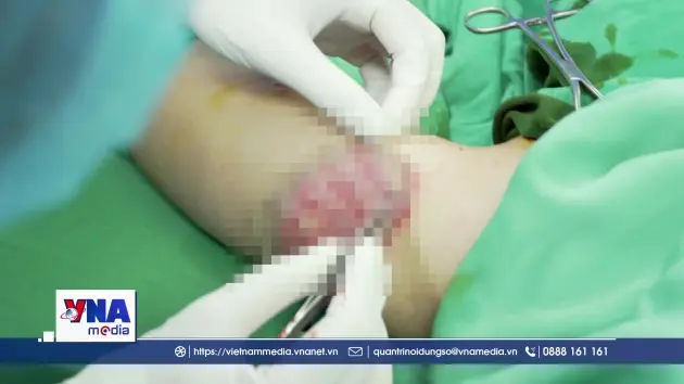 Đừng để làm đẹp trở thành tai họa