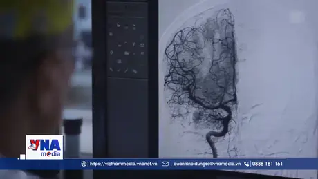 EU đẩy mạnh ứng dụng AI trong hệ thống chăm sóc sức khỏe