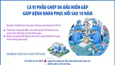 Ca vi phẫu ghép da đầu hiếm gặp giúp bệnh nhân phục hồi sau 10 năm