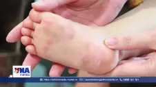Gần 100.000 ca tay chân miệng, tăng cường phòng dịch tại trường học