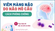 Cách phòng chống viêm màng não do não mô cầu
