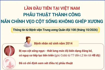 Lần đầu tiên tại Việt Nam phẫu thuật thành công nắn chỉnh vẹo cột sống không ghép xương