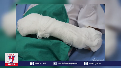 7 học sinh nhập viện do nổ bóng bay đã ổn định sức khỏe